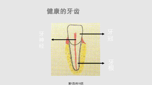 九篇根管治疗PPT课件