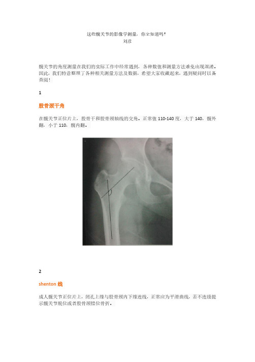 髋关节的影像学测量