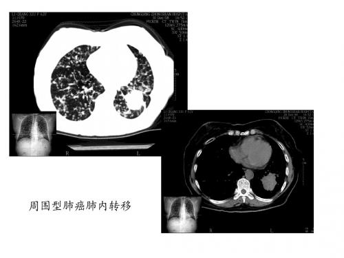 临床医学影像检查5