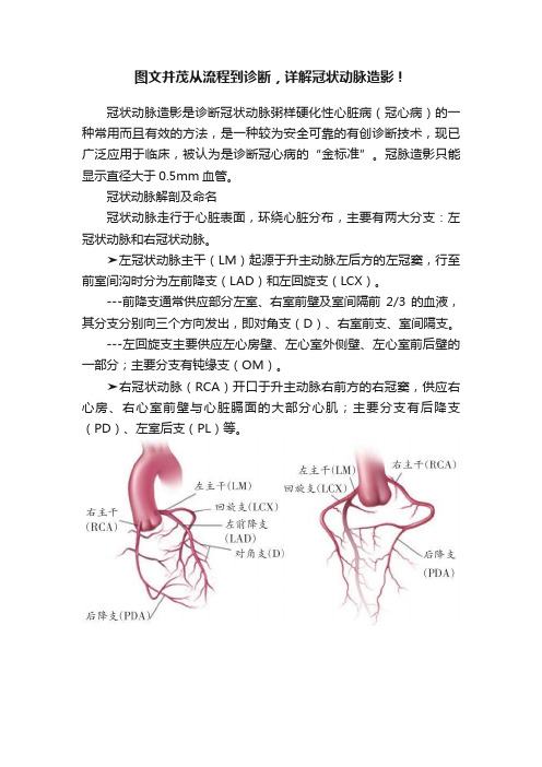 图文并茂从流程到诊断，详解冠状动脉造影！