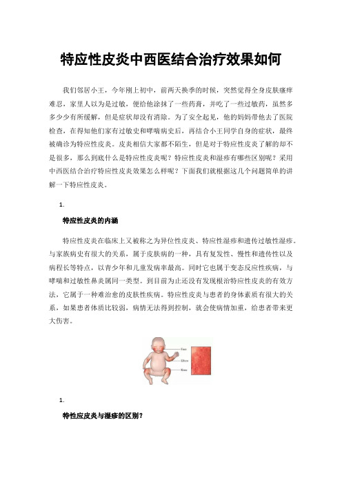 特应性皮炎中西医结合治疗效果如何