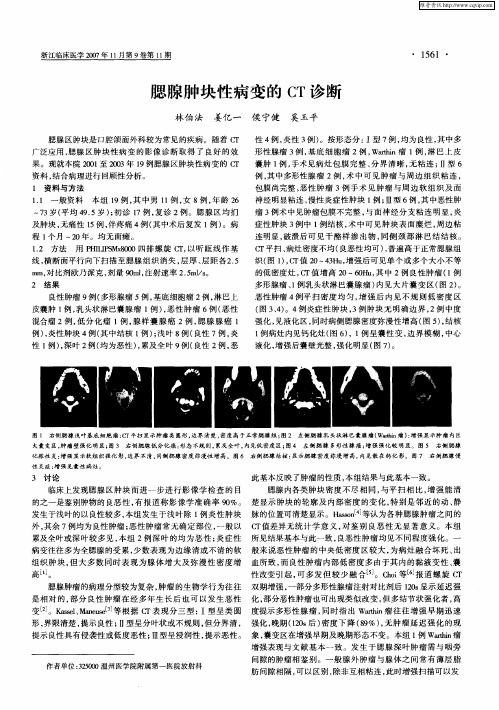 腮腺肿块性病变的CT诊断