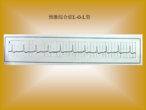 临床执业医师技能考试心电图及影像考试题答案PPT课件