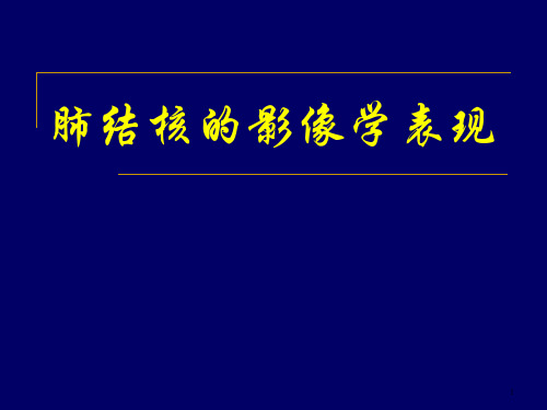 肺结核的影像学表现(2)精品PPT课件