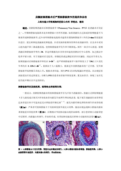 房颤射频消融后肺静脉狭窄