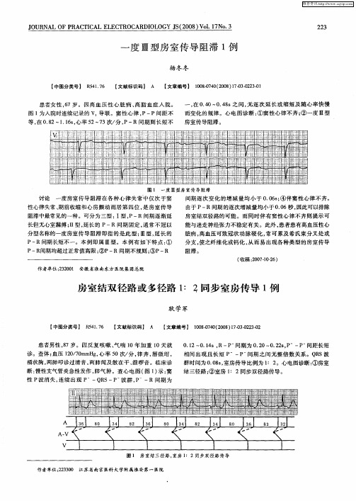 房室结双径路或多径路1：2同步室房传导1例