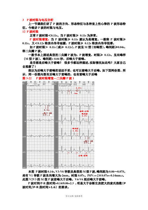 另类心电图学讲义4--P波时限与电压