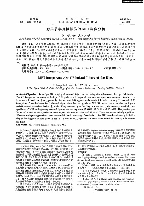 膝关节半月板损伤的MRI影像分析