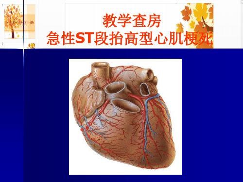 教学查房(急性心肌梗死)