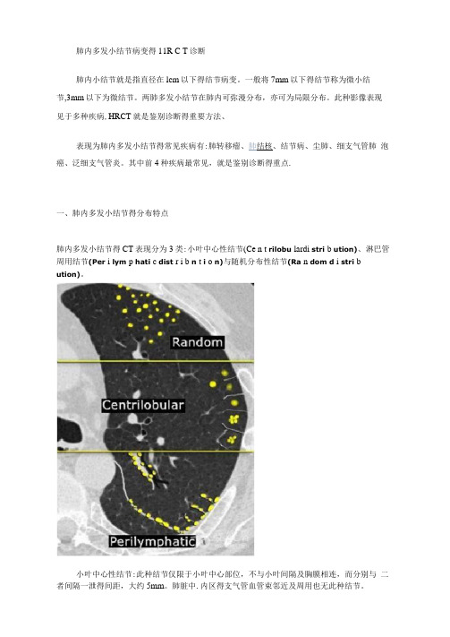 肺内多发小结节病变的HRCT诊断