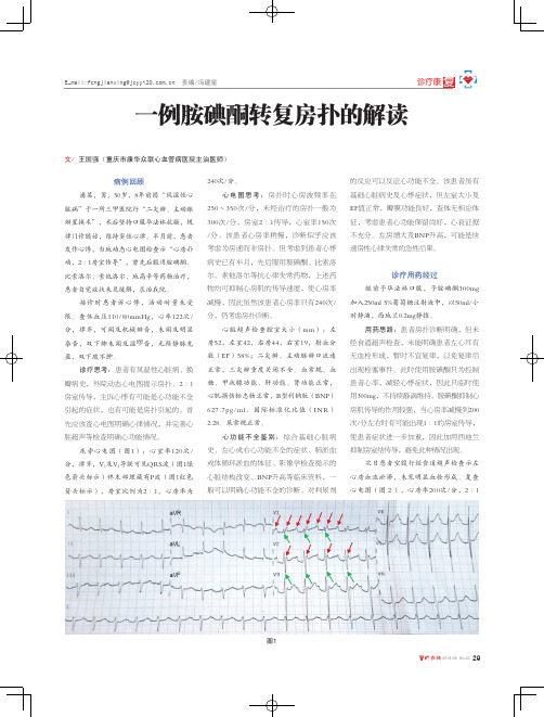一例胺碘酮转复房扑的解读
