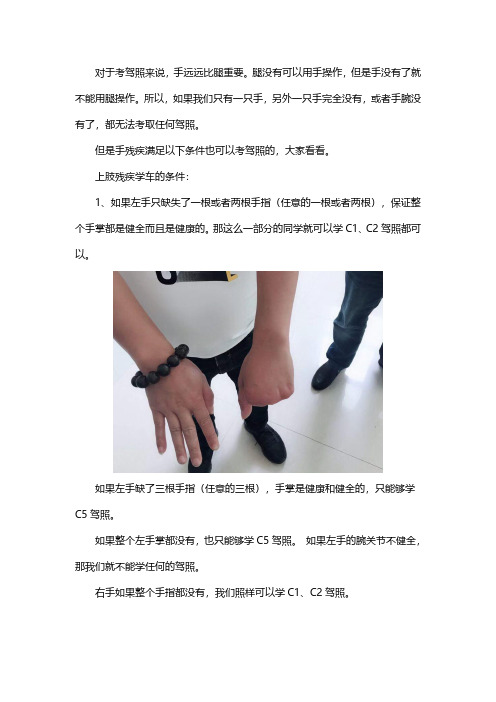 一只手可以考驾照吗