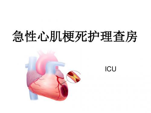 急性心肌梗死护理查房(ICU)