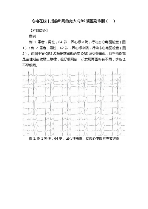 心电在线丨提前出现的宽大QRS波鉴别诊断（二）