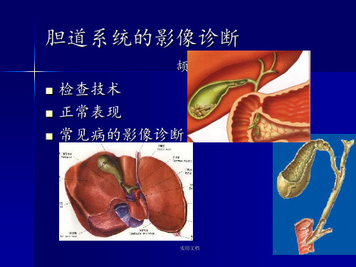 胆道系统的影像诊断