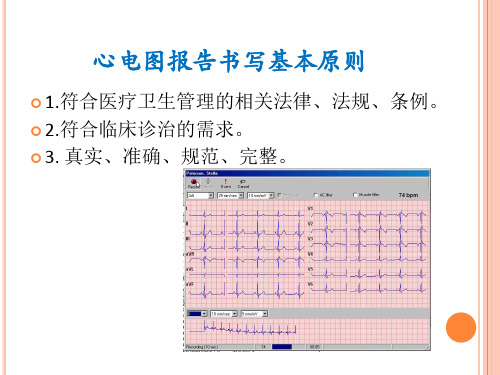 心电图报告的书写规范化及相关问题
