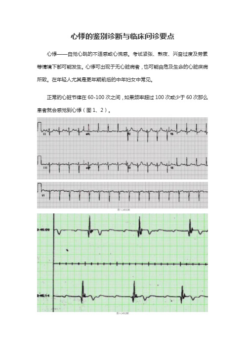 《心悸的鉴别诊断与临床问诊要点》