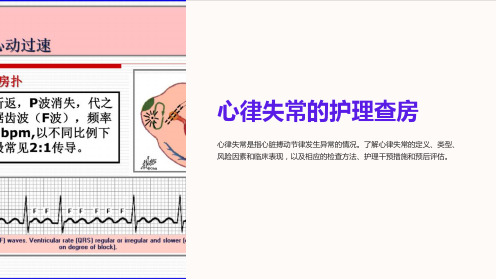 心律失常的护理查房