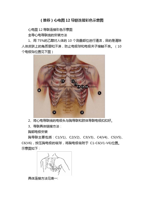 （推荐）心电图12导联连接彩色示意图