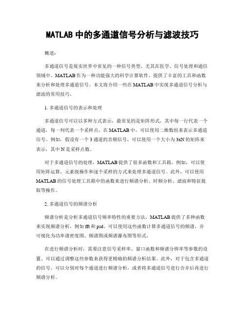 MATLAB中的多通道信号分析与滤波技巧