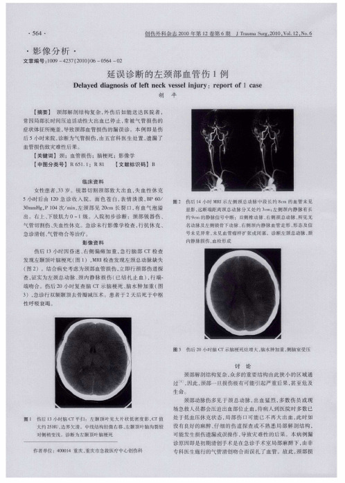 延误诊断的左颈部血管伤1例
