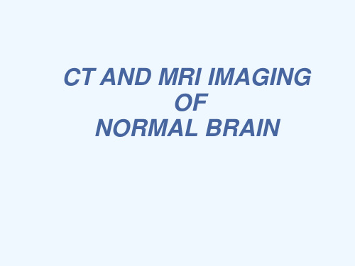 医学影像-正常颅脑CT和MR影像表