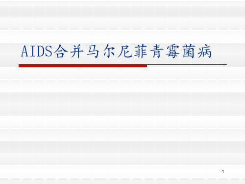 AIDS合并马尔尼菲青霉菌病件