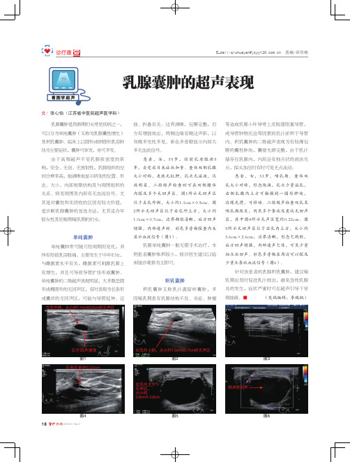 乳腺囊肿的超声表现