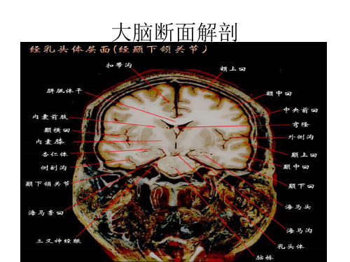 大脑结构图图例