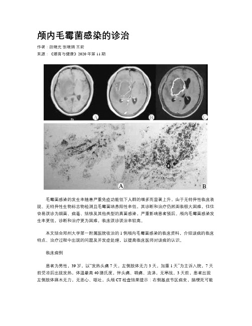 颅内毛霉菌感染的诊治