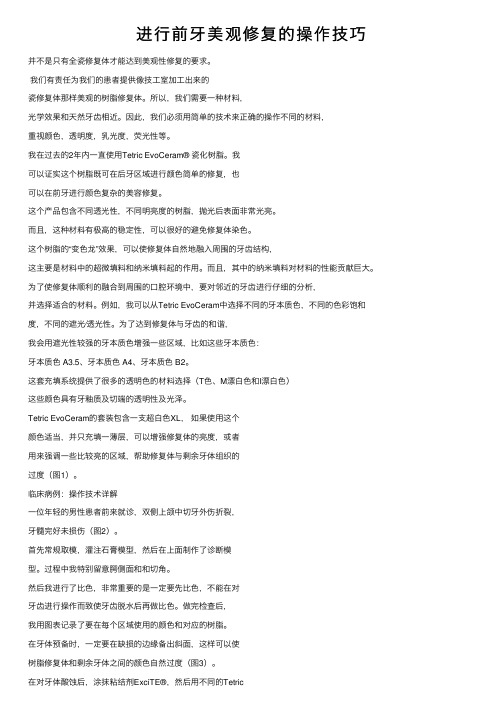 进行前牙美观修复的操作技巧