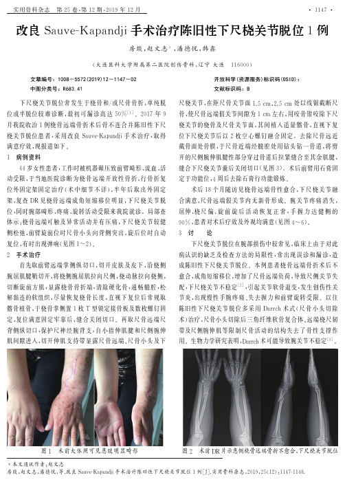 改良sauve-kapandji手术治疗陈旧性下尺桡关节脱位1例