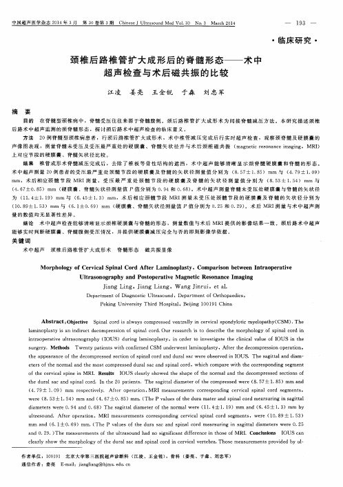 颈椎后路椎管扩大成形后的脊髓形态——术中超声检查与术后磁共振的比较