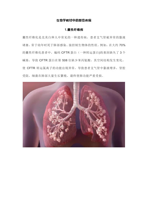 生物学教材中的那些疾病