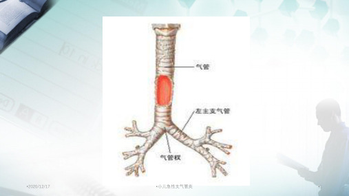 小儿急性支气管炎精选PPT干货