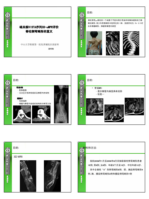 磁共振VISTA序列3D-cMPR评价 脊柱侧弯畸形的意义