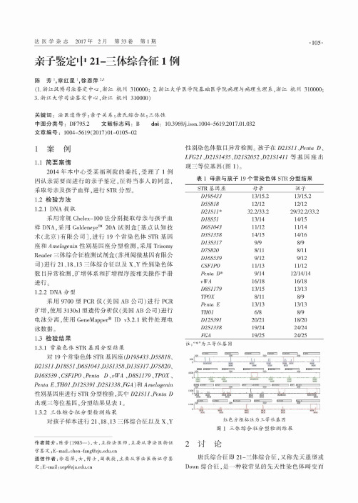 亲子鉴定中21-三体综合征1例