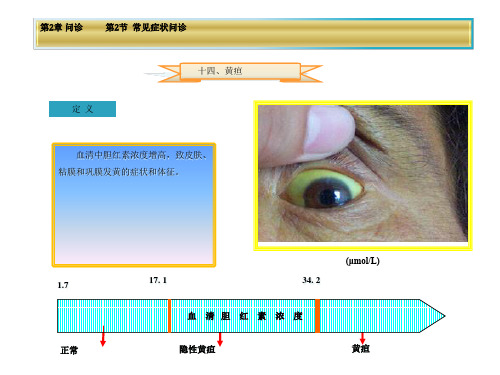 健康评估第2章第2节黄疸课件