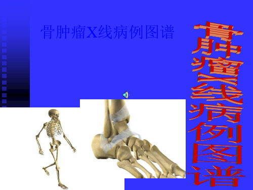 骨肿瘤X病例图谱