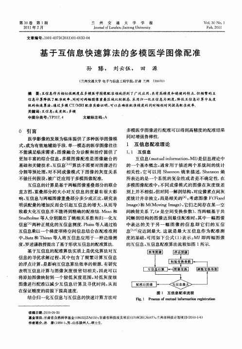 基于互信息快速算法的多模医学图像配准