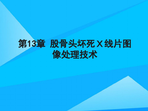 医学图像处理技术优质PPT