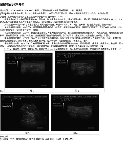 阑尾炎的超声分型