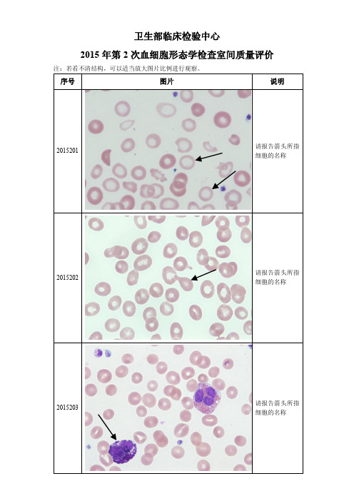 卫生部2015年第2次血细胞形态学检查室间质量评价.