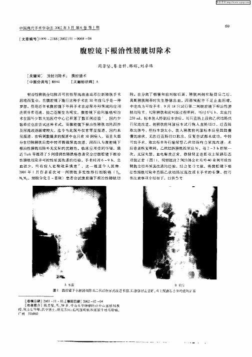 腹腔镜下根治性膀胱切除术