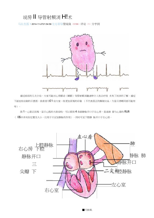 图说房颤导管射频消融术