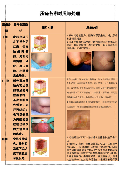 压疮各期对照表(彩图)1