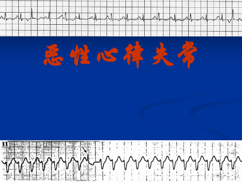 恶性心律失常