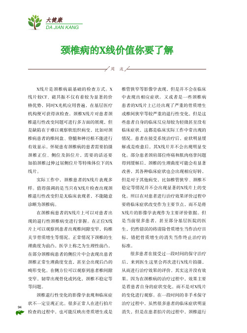 颈椎病的x线价值你要了解