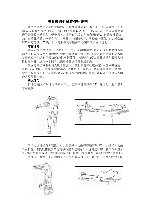 股骨髓内钉