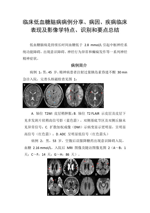 临床低血糖脑病病例分享、病因、疾病临床表现及影像学特点、识别和要点总结